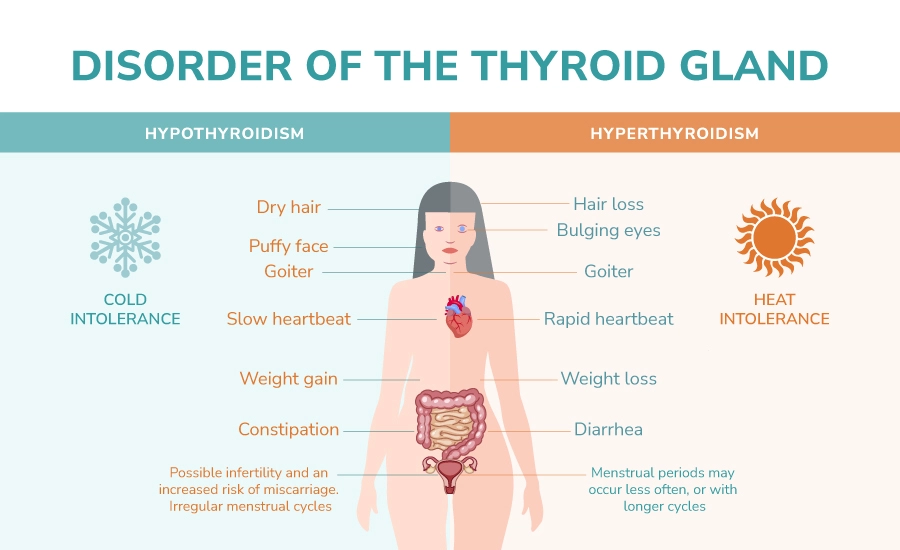 Die Schilddrüse ist ein schmetterlingsförmiges Organ an der Vorderseite des Halses, das zwei Arten von Hormonen ausscheidet: Trijodthyronin (T3) und Thyroxin (T4). Diese Hormone regulieren den Stoffwechsel des Körpers, der die Nahrung in Energie umwandelt. Die Schilddrüse wird durch das schilddrüsenstimulierende Hormon (TSH) gesteuert, das von der Hirnanhangsdrüse im Gehirn produziert wird.