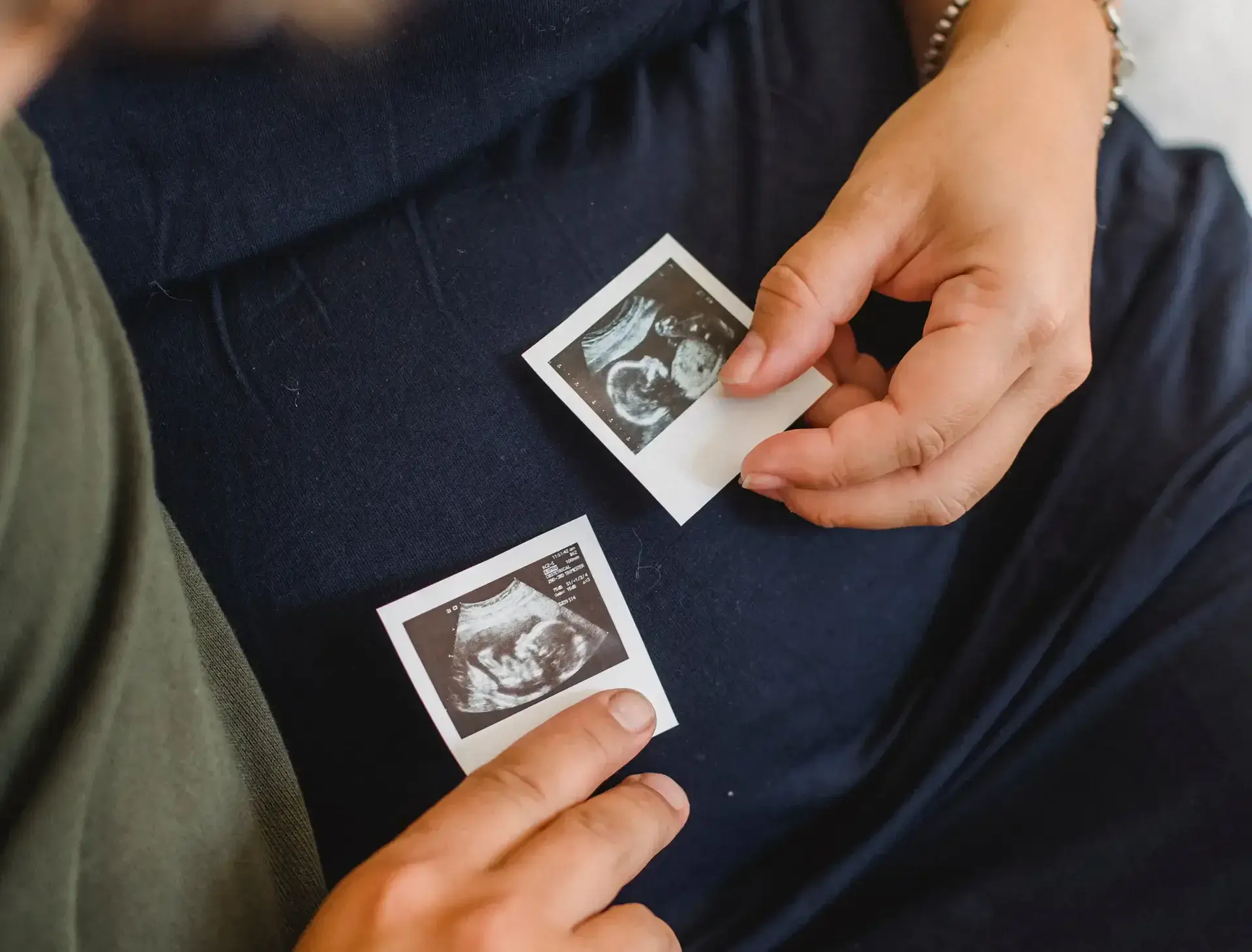 ultrasound scans of baby held by a pregnant woman