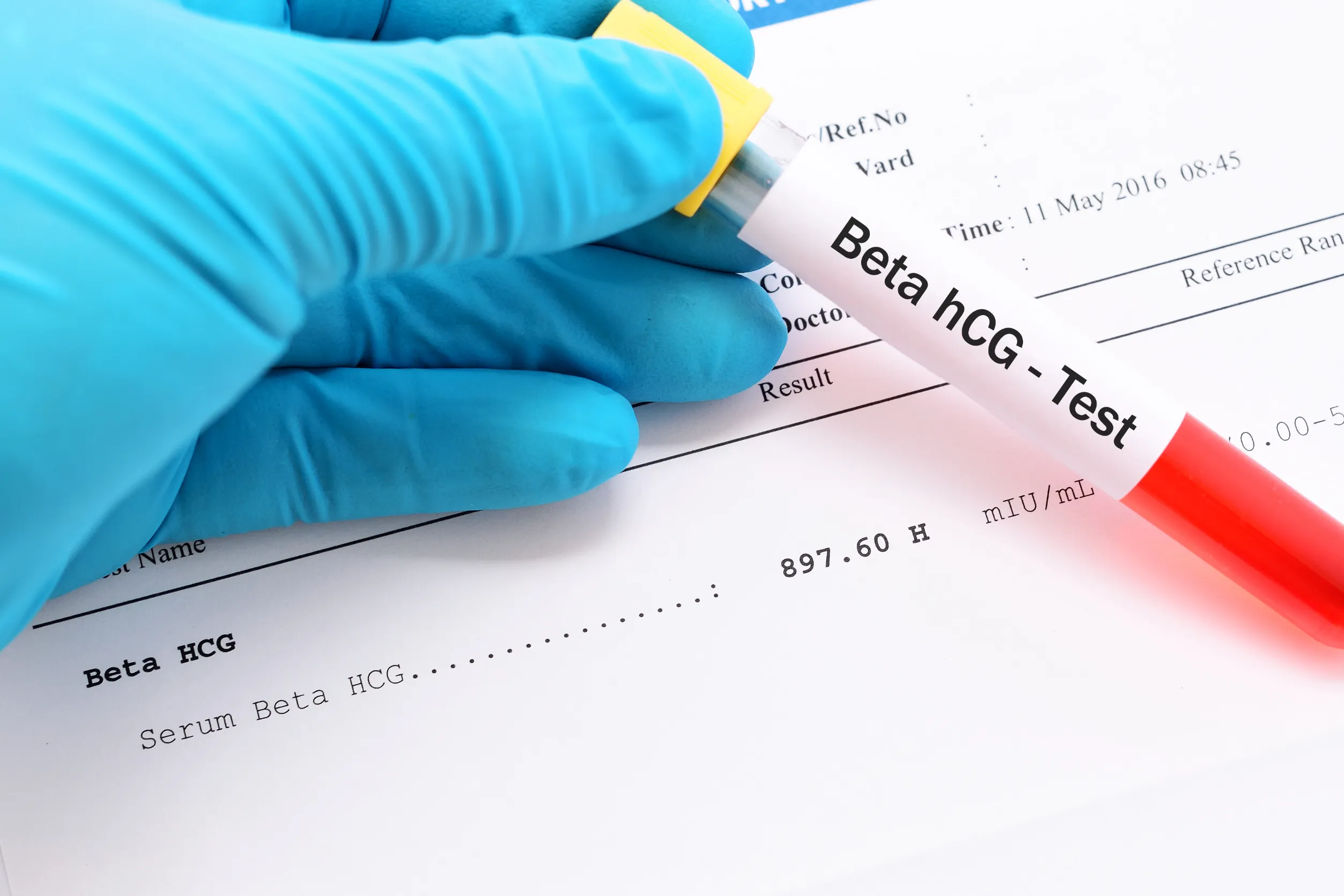 Beta hCG test vial held over paper
